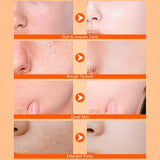 Kojic Acid & Turmeric Body Spray